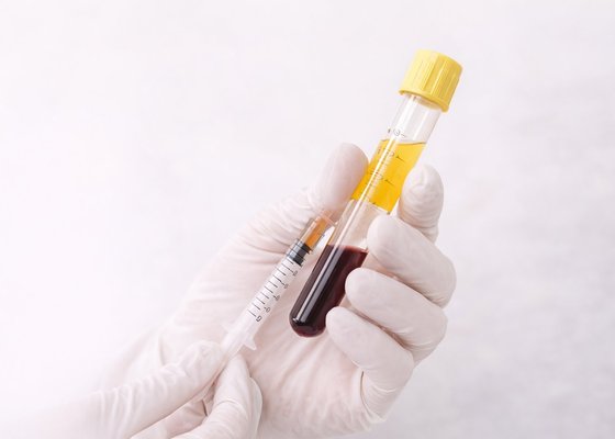 PRP · PRF · PRF gel